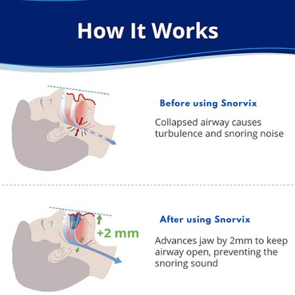 Snorvix Rest MouthPiece™